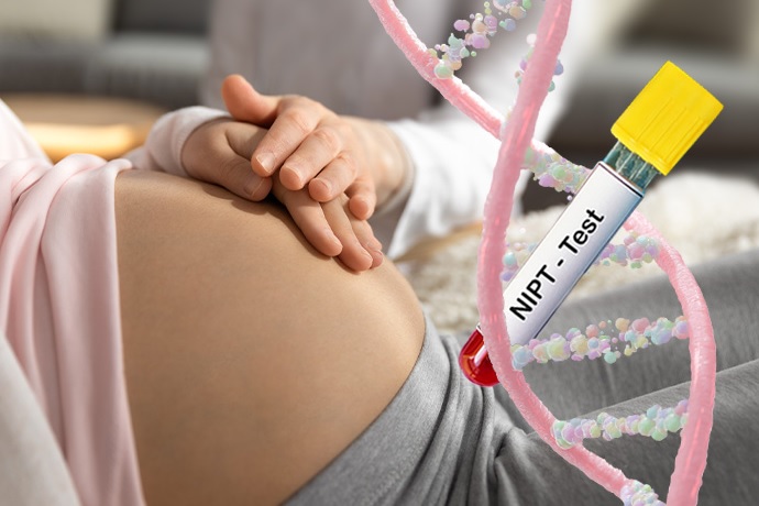 NIPT (Non Invasive Prenatal Testing)